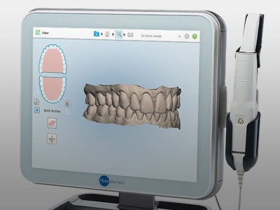 Digital Impressions Berkeley Family Orthodontics in Berkeley, CA