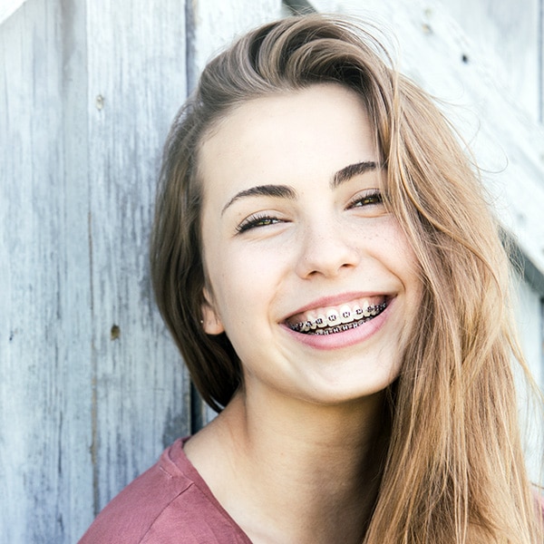 Types of Braces Berkeley Family Orthodontics in Berkeley, CA